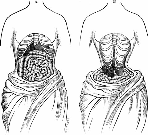 S-Curve Corset