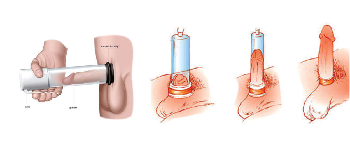 diagram of a using a pump